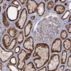 Anti-TAS1R1 Antibody