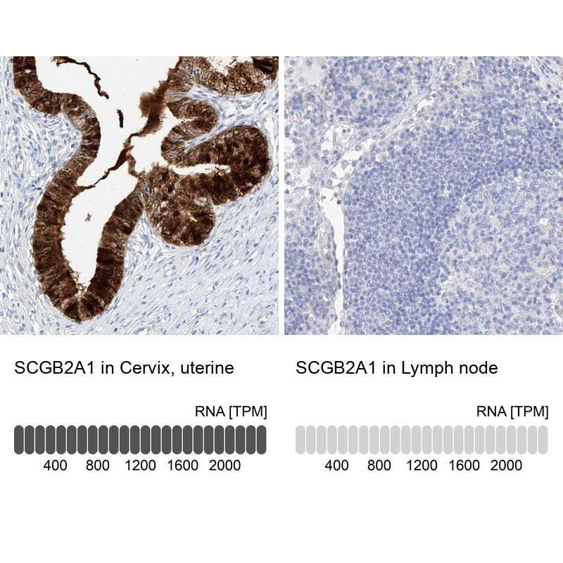 Anti-SCGB2A1 Antibody