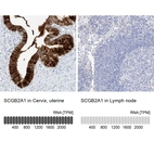 Anti-SCGB2A1 Antibody