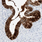 Immunohistochemical staining of human Cervix shows strong cytoplasmic positivity in glandular cells.