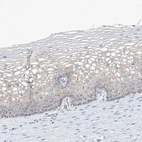 Immunohistochemical staining of human Cervix shows moderate membranous positivity in squamous epithelial cells.