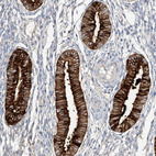 Immunohistochemical staining of human Endometrium shows strong cytoplasmic positivity in glandular cells.