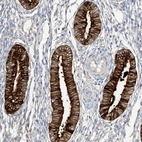 Immunohistochemical staining of human Endometrium shows strong cytoplasmic positivity in glandular cells.
