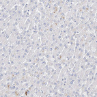 Immunohistochemical staining of human Liver shows no positivity in hepatocytes as expected.