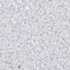 Immunohistochemical staining of human Liver shows no positivity in hepatocytes as expected.