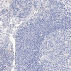Immunohistochemical staining of human Lymph node shows no positivity in non-germinal center cells as expected.