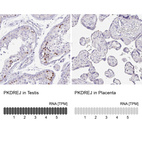 Anti-PKDREJ Antibody