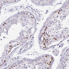 Anti-PKDREJ Antibody