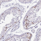 Immunohistochemical staining of human testis shows high expression.