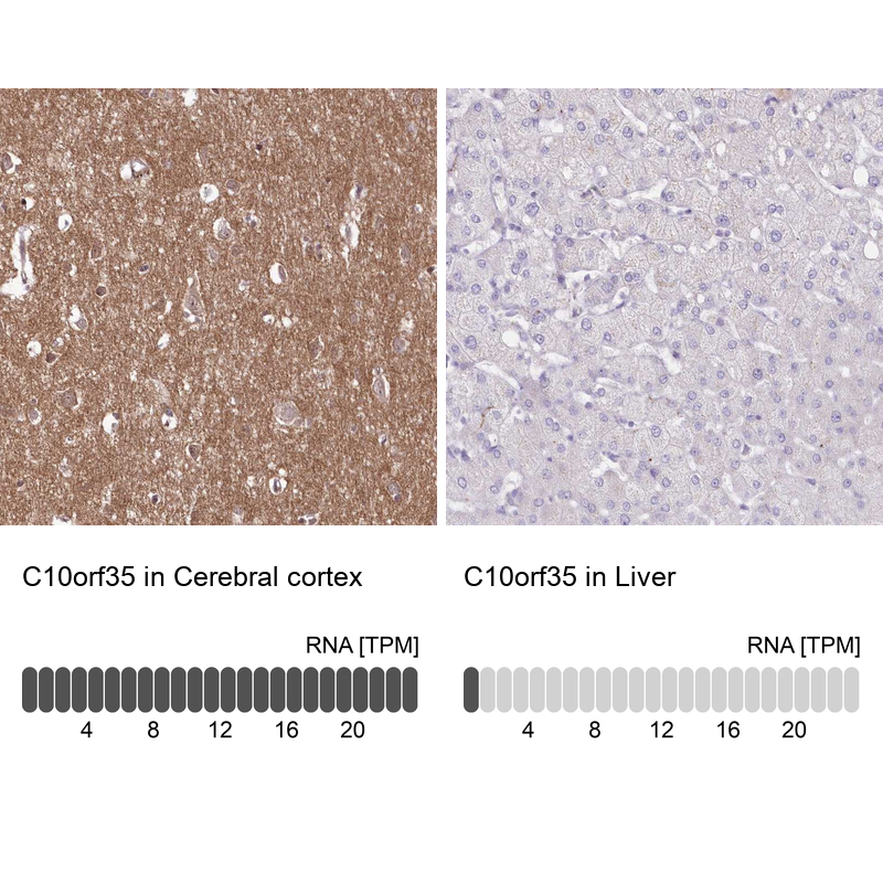 Anti-C10orf35 Antibody