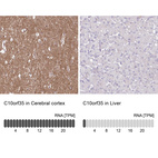 Anti-C10orf35 Antibody