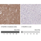 Anti-C10orf35 Antibody