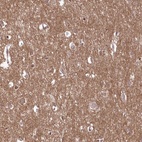Immunohistochemical staining of human cerebral cortex shows high expression.