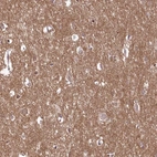 Immunohistochemical staining of human cerebral cortex shows high expression.