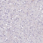 Anti-C10orf35 Antibody