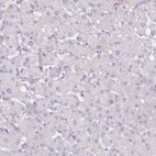 Immunohistochemical staining of human liver shows low expression as expected.