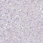 Immunohistochemical staining of human liver shows low expression as expected.