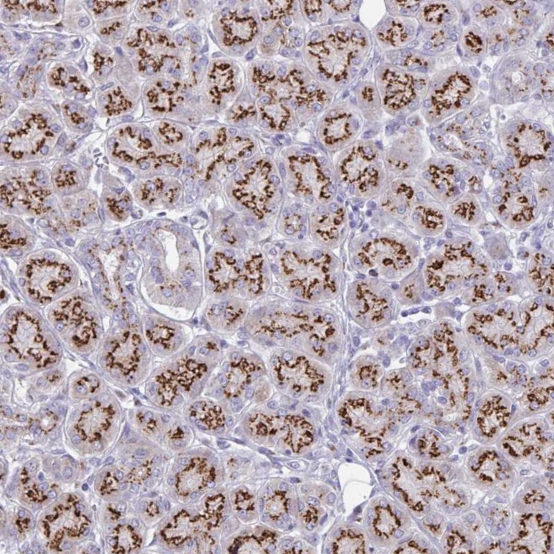 Anti-MCFD2 Antibody