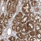 Anti-LONRF2 Antibody