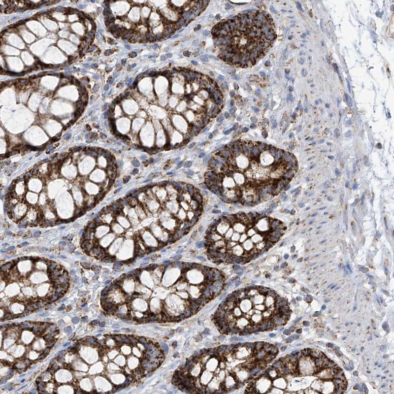 Anti-PNPT1 Antibody