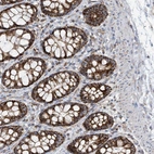 Anti-PNPT1 Antibody