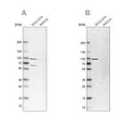 Western blot analysis using Anti-PNPT1 antibody HPA034602 (A) shows similar pattern to independent antibody HPA034603 (B).