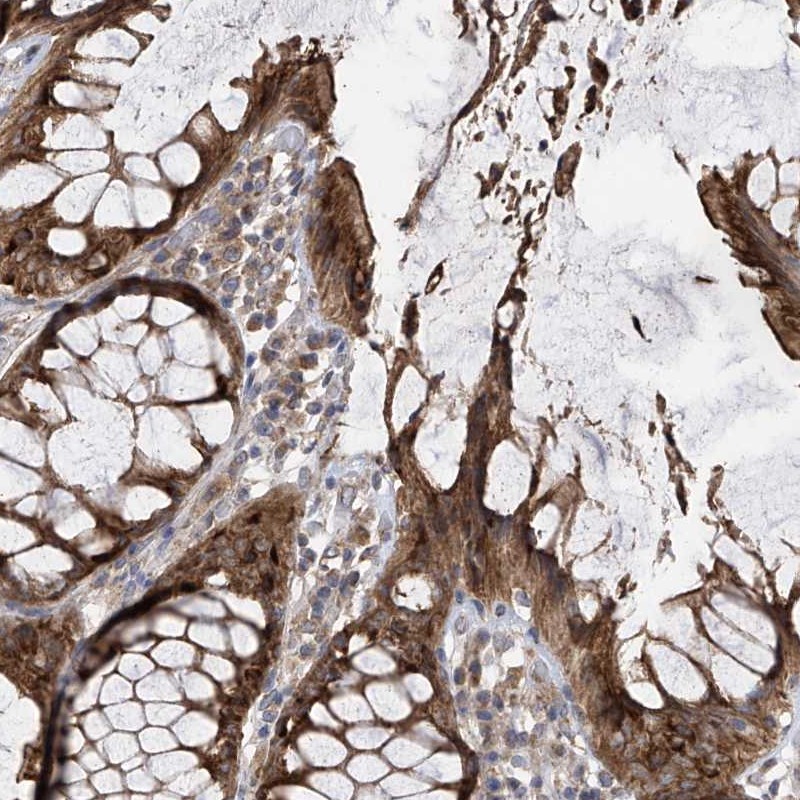 Anti-PNPT1 Antibody