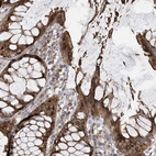 Anti-PNPT1 Antibody