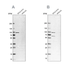 Western blot analysis using Anti-PNPT1 antibody HPA034603 (A) shows similar pattern to independent antibody HPA034602 (B).