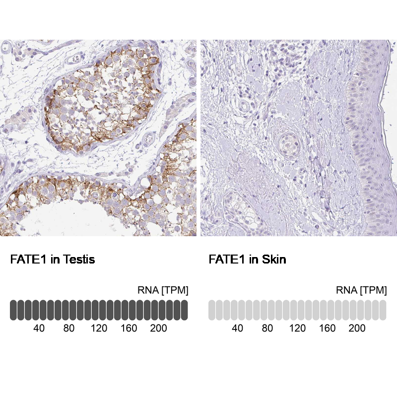 Anti-FATE1 Antibody