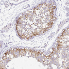 Immunohistochemical staining of human testis shows moderate cytoplasmic-membranous positivity in cells in seminiferous ducts.