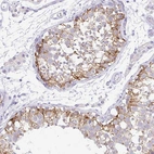 Immunohistochemical staining of human testis shows moderate cytoplasmic-membranous positivity in cells in seminiferous ducts.