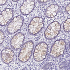 Immunohistochemical staining of human rectum shows weak cytoplasmic positivity in glandular cells.