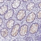 Immunohistochemical staining of human rectum shows weak cytoplasmic positivity in glandular cells.