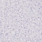 Immunohistochemical staining of human liver shows no positivity in hepatocytes as expected.