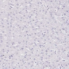 Immunohistochemical staining of human liver shows no positivity in hepatocytes as expected.