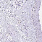 Immunohistochemical staining of human skin shows no positivity in squamous epithelial cells as expected.