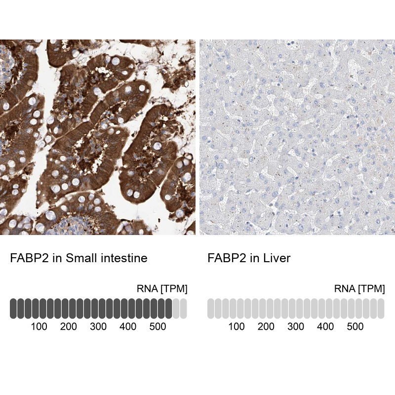 Anti-FABP2 Antibody