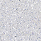 Immunohistochemical staining of human liver shows no positivity in hepatocytes as expected.
