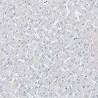 Immunohistochemical staining of human liver shows no positivity in hepatocytes as expected.