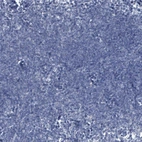 Immunohistochemical staining of human lymph node shows no positivity in non-germinal center cells as expected.