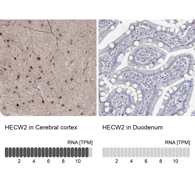 Anti-HECW2 Antibody