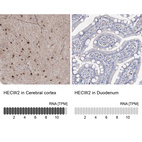 Anti-HECW2 Antibody