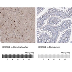 Anti-HECW2 Antibody