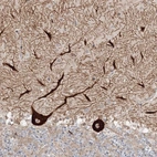 Immunohistochemical staining of human cerebellum shows strong cytoplasmic positivity in Purkinje cells.