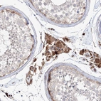 Immunohistochemical staining of human testis shows moderate cytoplasmic positivity in Leydig cells.