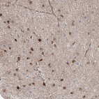 Immunohistochemical staining of human cerebral cortex shows moderate to strong cytoplasmic positivity in glial cells.