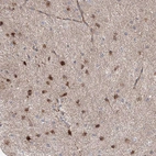 Immunohistochemical staining of human cerebral cortex shows moderate to strong cytoplasmic positivity in glial cells.