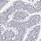 Immunohistochemical staining of human duodenum shows no positivity in glandular cells as expected.