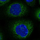 Immunofluorescent staining of human cell line A-431 shows localization to endoplasmic reticulum.